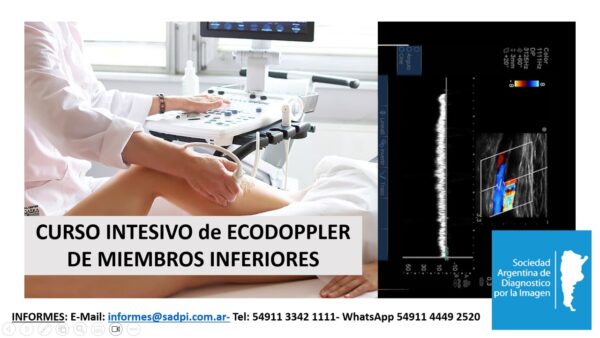 CURSO EN DOPPLER VASCULAR DE MIEMBROS INFERIORES