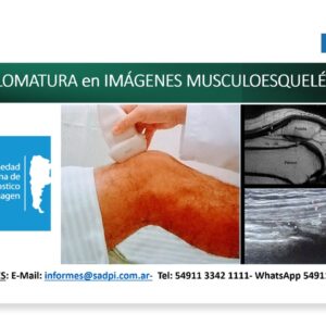 DIPLOMATURA EN IMAGENES MUSCULOESQUELÉTICAS. ON LINE