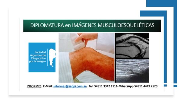 DIPLOMATURA EN IMAGENES MUSCULOESQUELÉTICAS. ON LINE