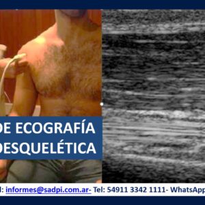 CURSO DE ECOGRAFÍA MUSCULOESQUELÉTICA. ON LINE