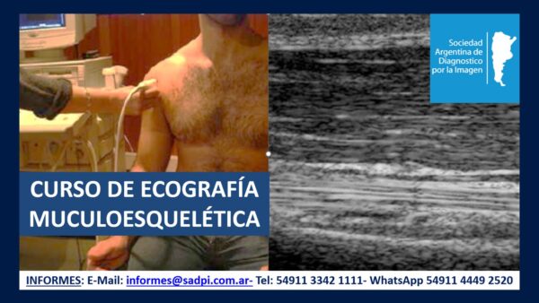 CURSO DE ECOGRAFÍA MUSCULOESQUELÉTICA. ON LINE