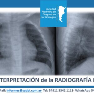 CURSO ONLINE DE INTERPRETACION DE LA RADIOGRAFIA DE TORAX DEL LACTANTE