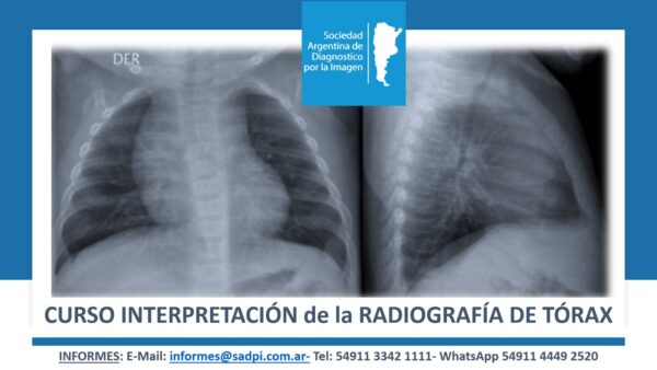 CURSO ONLINE DE INTERPRETACION DE LA RADIOGRAFIA DE TORAX DEL LACTANTE