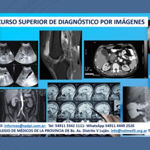CURSO SUPERIOR DE DIAGNÓSTICO POR IMÁGENES